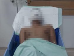 Gara-gara Berita, Pemred Media Online di Sumut Disiram Air Keras