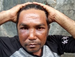 Miris! Wartawan Media Online Ini Diculik, Dirampok dan Digebuki Habis-habisan, Satu Pelaku Mengaku Intel Polisi