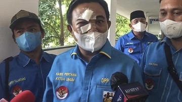 Ketetangan foto: Wajah Ketua Umum KNPI Haris Pratama babak belur usai dikeroyok OTK pada Senin (21/02/2022). (CNNIndonesia.com/Istimewa)