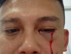 Wartawan Metro Tv Dianiaya Oknum Polisi
