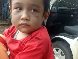 Puji Tuhan! Bocah Korban Penganiayaan oleh IRT Kini Sudah Pulang ke Rumah