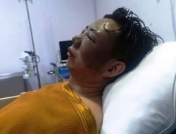 Liu Fei alami Kebutaan akibat Siraman air Keras, Tok! Hakim Hanya putus Terdakwa hukuman 1 tahun 6 bulan