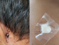 Dua Pihak Saling Lapor Kasus Penganiayaan di Karimunting, Tim Kuasa Hukum Minta Polisi Objektif